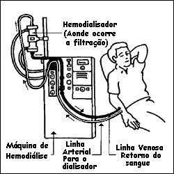 Diagrama de como a máquina de hemodiálise funciona.
